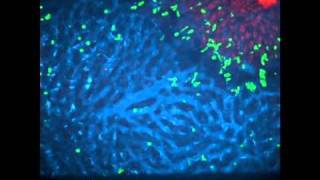 White Blood Cells Migrating Through Blood Vessels