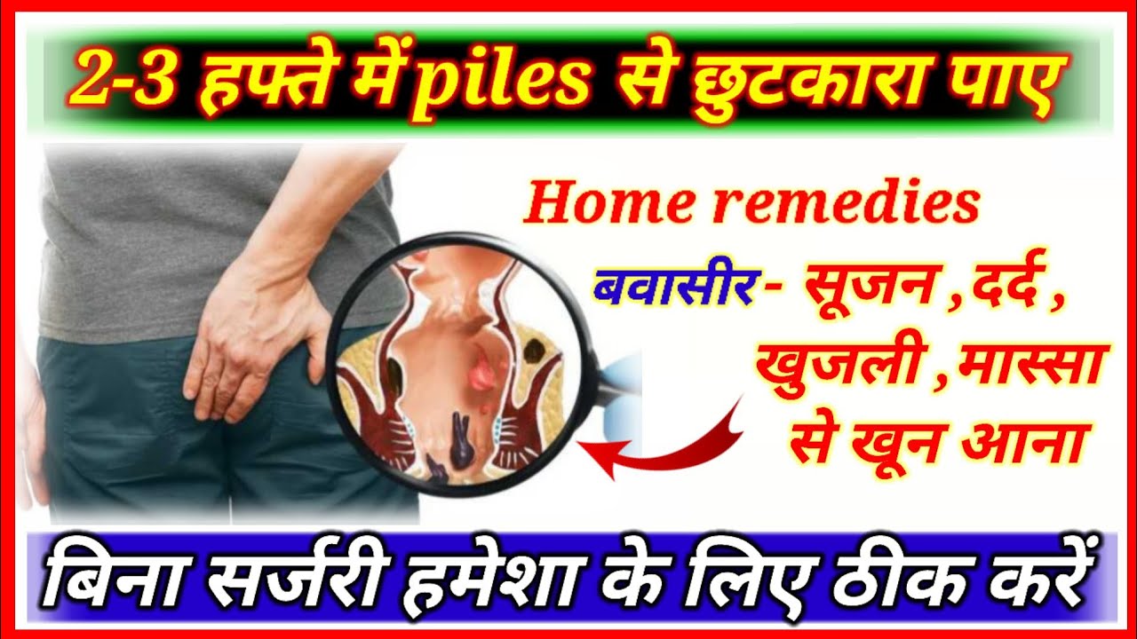 बवासीर (Piles) home remedies/बिना सर्जरी हमेशा के लिए ठीक करें... YouTube