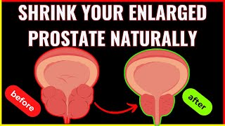 shrink your enlarged prostate naturally Say Goodbye to BPH!