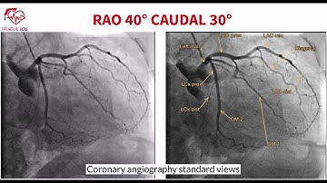 Coronary angiography standard views