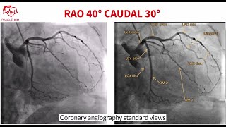 Coronary angiography standard views