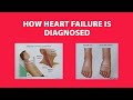How Heart Failure is Diagnosed