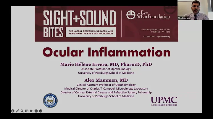 Sight + Sound Bites: Ocular Inflammation