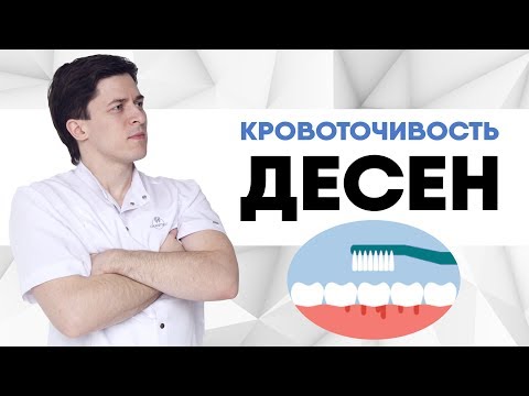 Кровоточивость десен. Что делать, если кровят десна при чистке зубов? Как укрепить десна.