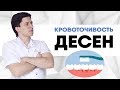 Кровоточивость десен. Что делать, если кровят десна при чистке зубов? Как укрепить десна.