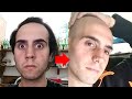 Balding man more attractive after shaving head bald