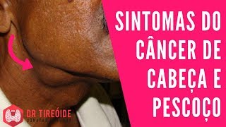 De sem nas caroço edema extremidades inferiores imagens
