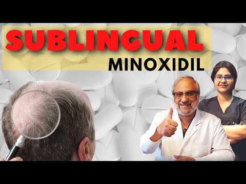 Oral Minoxidil | Sublingual Minoxidil | Complete Guide