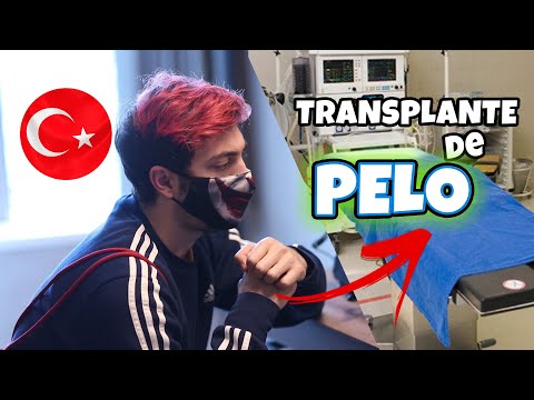 Nos vamos a TURQUÍA a PONERNOS PELO!!😱