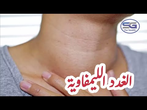 أسباب تضخم الغدد الليمفاوية