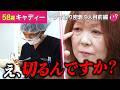 【クマ取り密着】目の下のたるみが強い58歳「皮膚を切りたくない」と悩み選んだ治療は....【クマ取り密着9人目前編】#目の下のたるみ#美容整形#クマ取り#切開#湘南美容クリニック