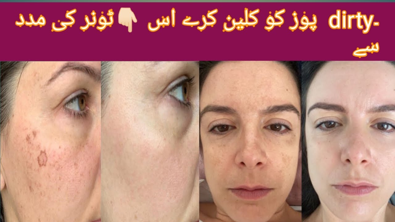 how to make aloe vera toner at home!!ghar me toner banane ka tarika