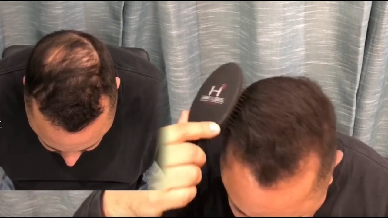 Amazing Hair Fiber Demo (Boldify vs Hair3) YouTube