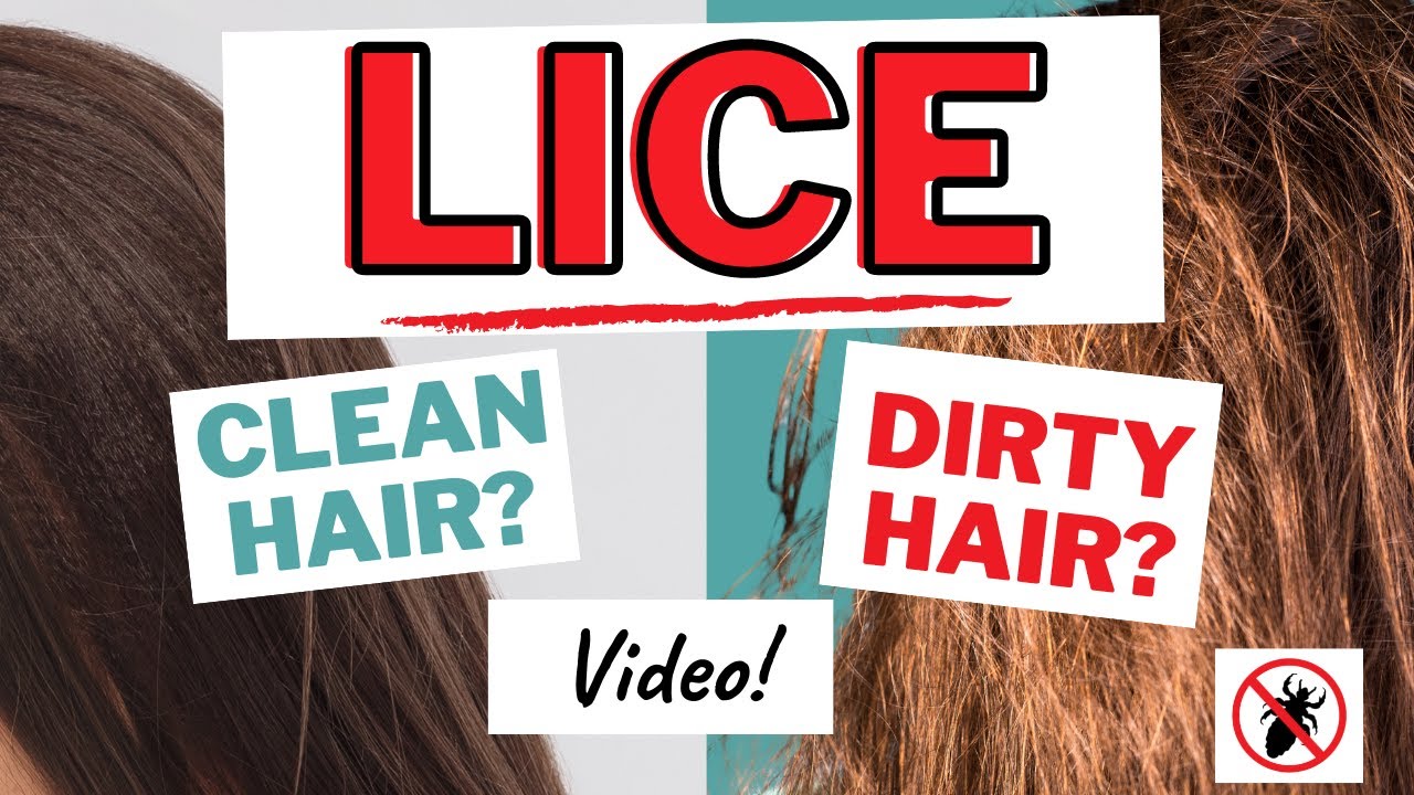 Do Lice Like Clean Hair or Dirty Hair Video - thptnganamst.edu.vn