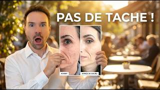 Taches Brunes : Comment Les Éviter Cet Été ? ☀️