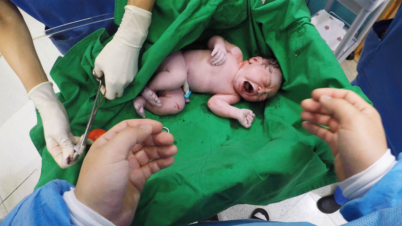 아기가 태어났습니다 (솜이 유도분만부터 제왕절개 수술 탄생까지 출산 브이로그)