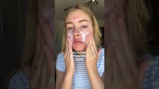 5 months on accutane VLOG