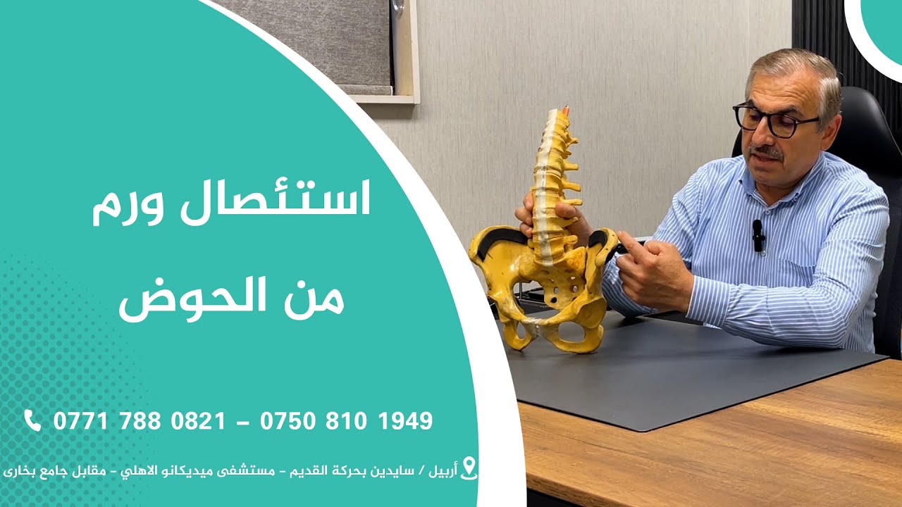 استئصال ورم من الحوض