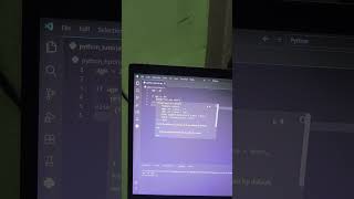 Python If-Else Explained in 30 Seconds 🔥 #shorts