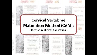 Cervical Vertebral Maturation method (CVM): Method & Clinical application screenshot 1