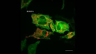 Microtubule growth in HEK293 cells