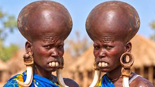 15 Rare People On Earth Who Seem Too Strange To Be Real