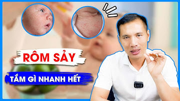 TRẺ BỊ RÔM SẢY tắm nước gì NHANH KHỎI? Tham khảo cách PHÒNG NGỪA rôm sảy cho BÉ | DS Trương Minh Đạt