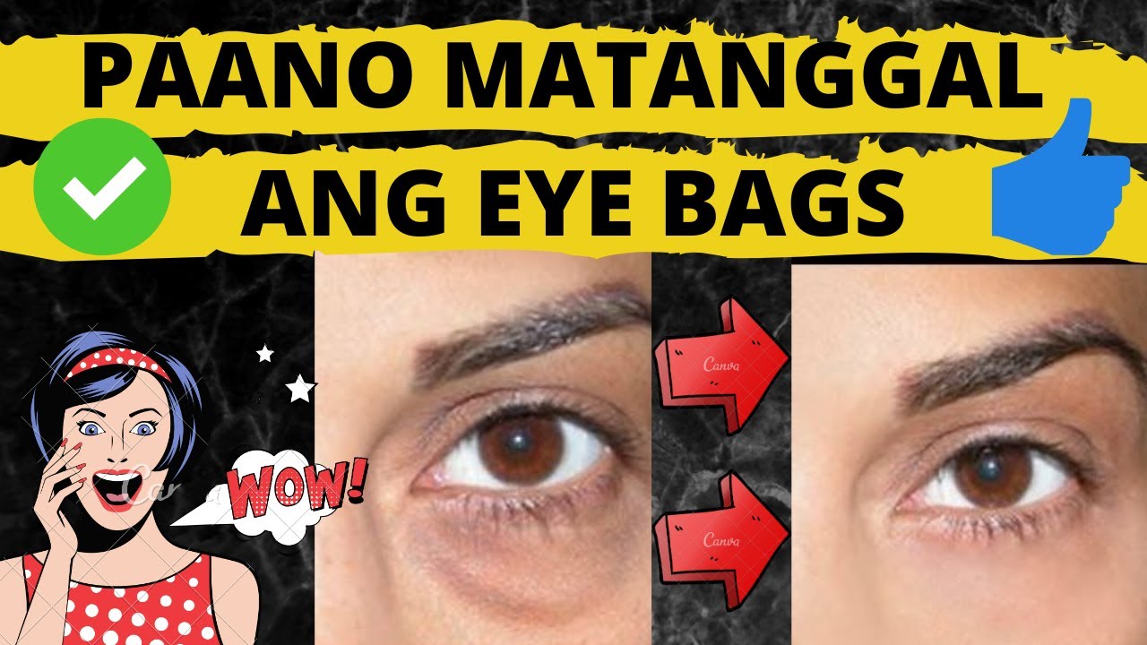 Anong Mabisang Gamot Sa Eyebags - medisinagamot