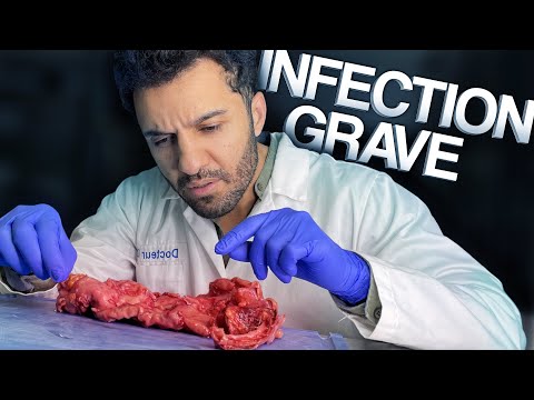 Urgence chirurgicale : organe perforé !