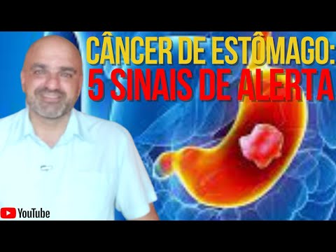 Vídeo: 3 maneiras de reconhecer o câncer de estômago