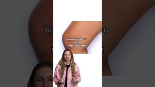 Фолликулярный гиперкератоз или гусиная кожа