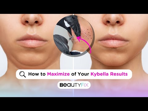 ChinFix: Kybella