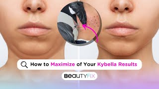 What to do AFTER Getting Kybella? | BeautyFix