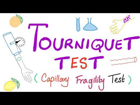 Tourniquet Test (Capillary Fragility Test)