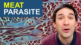 Why I would not eat this meat |  Parasite Worms in meat under the microscope