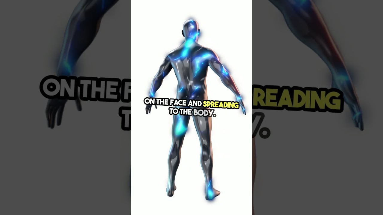 Monkeypox Symptoms Explained: What You Need to Know!