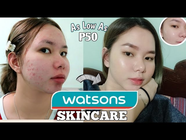 PAANO MAWALA ANG BUMPS ✨ (Butlig) | HOW I CLEARED MY SKIN JOURNEY + WATSONS SKINCARE class=