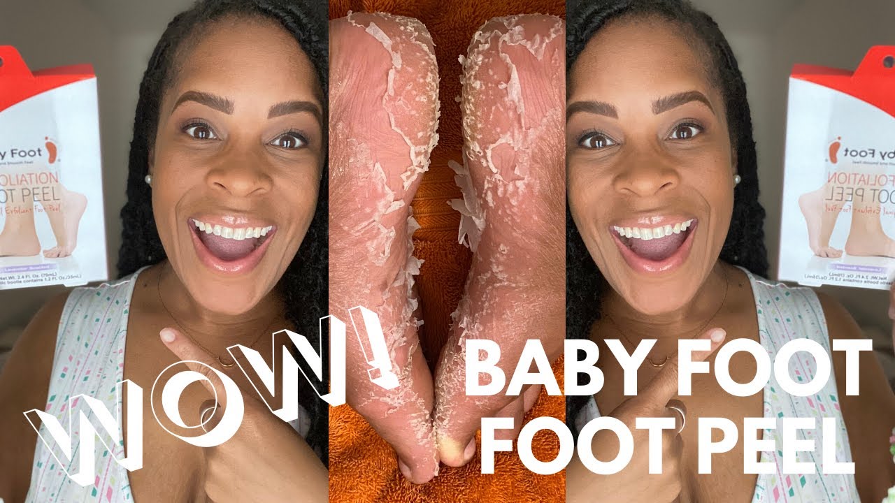 ***BABY FOOT EXFOLIATING FOOT PEEL IS BOMB!*** FULL REVIEW! YouTube