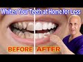 Whiten Your Teeth at Home for Nearly Free!  Dr. Mandell