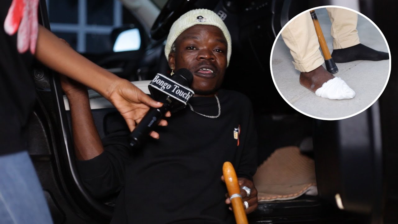 HARMORAPA ato siri wanachofanyiwa baada ya Vidole kukatwa Zimbabwe inatisha