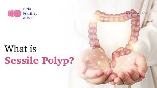 What Is Sessile Polyp Birla Fertility & Ivf