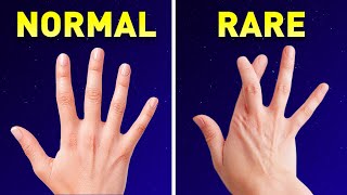 We All Have Different Bodies with Interesting Features and Great Body Parts, Here's the Proof