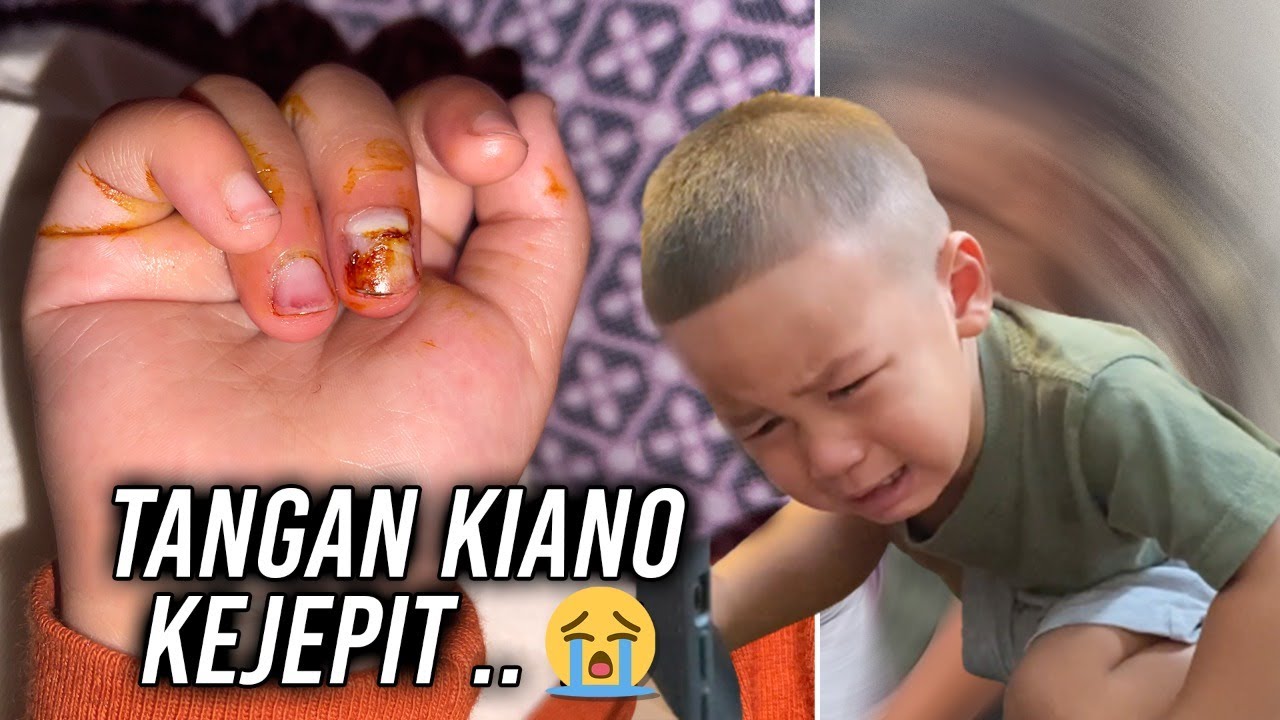 KECELAKAAN, MUSIBAH .. INSYAALLAH GPP KIANO .. KUAT ANAK PAPAH 💪 .. #SeremBangetLiatnya