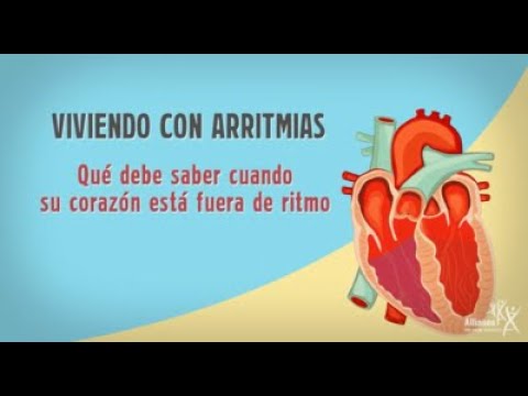 Qu es la arritmia ventricular, el problema de salud que aleja a ...