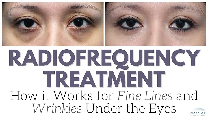 How Radiofrequency Devices Work on Fine Lines and Wrinkles, and Why it's Not the Only Treatment