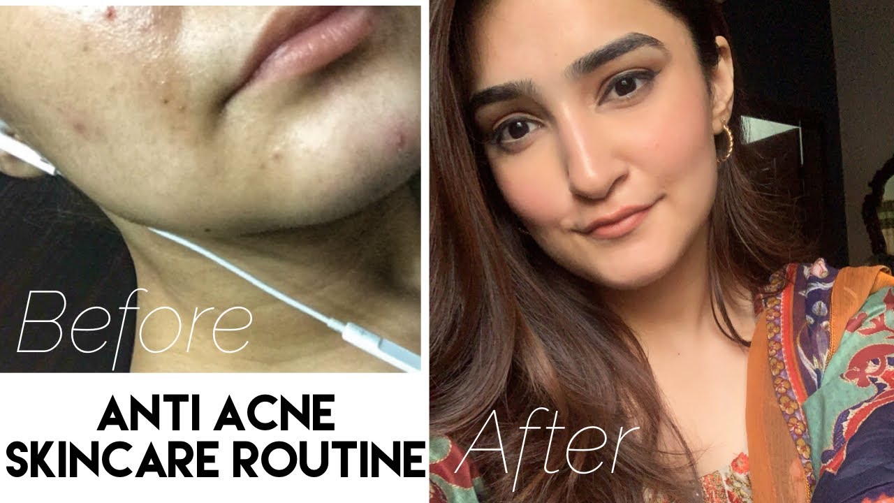 HOW I GOT RID OF MY ACNE - Morning & Night Skincare Routine - YouTube