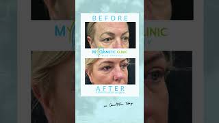Cosmetic Surgery Sydney - My Cosmetic Clinic