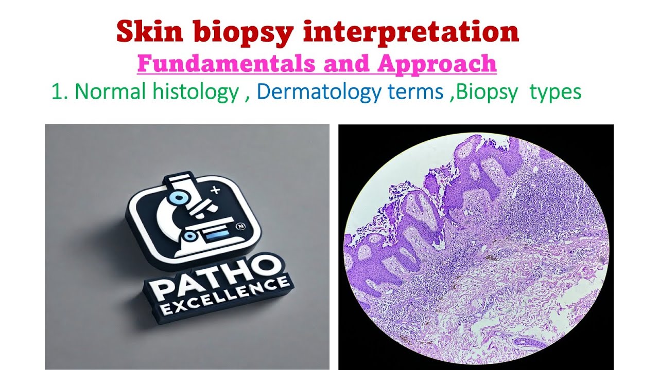 Skin Biopsy Interpretation – Fundamentals Approach Histology, Dermatology Terms & Biopsy Types Ep 1