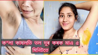 আপোনালোকৰো যদি কাষলতি তল ক'লা হৈ গৈছে দূৰ কৰক মাএ ৫ মিনিটতে/How to get white underarms