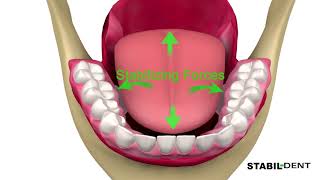 Denture Stablizers-How To Keep Lower Dentures In Place screenshot 4